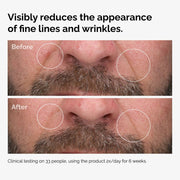 Before and After showing how 100% Fermented Rose Hip Seed Oil reduces fine lines and wrinkles